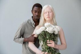 La strage degli albini africani